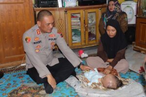 Kapolres Asahan Jenguk Penderita Hidrosefalus 2 IMG 20230509 WA0054